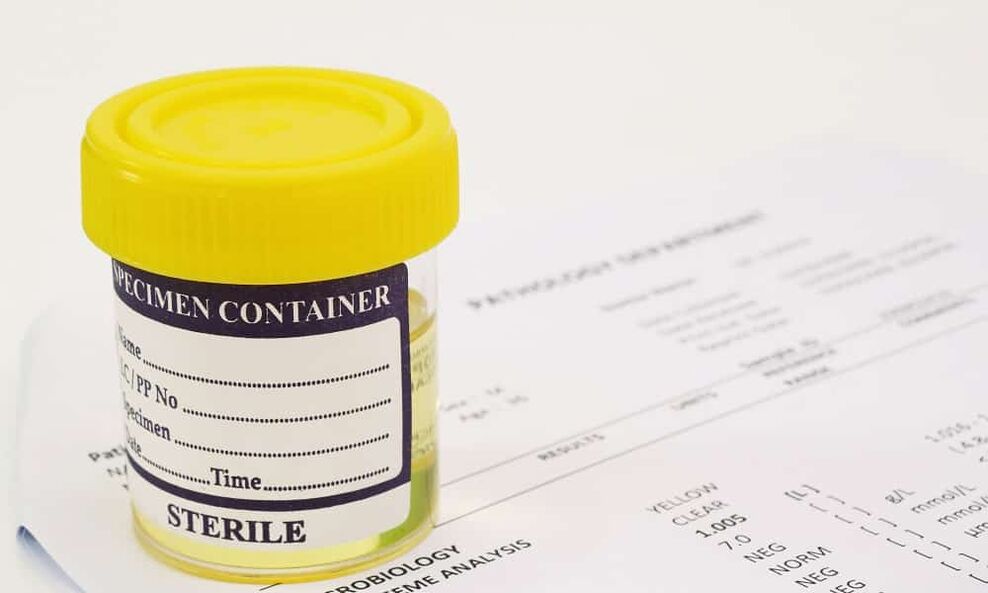 Przed przyjęciem antybiotyków należy wykonać badanie moczu